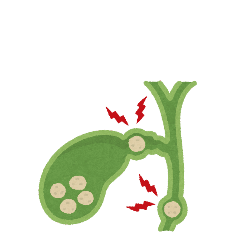 ayurvedic-gallbladder-treatment